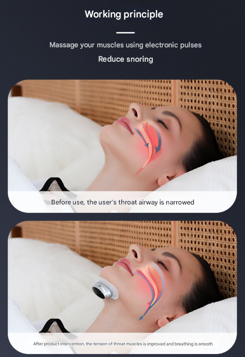 Black Smart Anti-Snoring Device - Rechargeable Pulse Throat Stimulator for Quieter Sleep