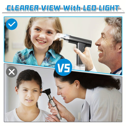 Rechargeable Electric Ear Wax Removal Kit - 3 Pressure Modes, LED Light & 90-Day Battery Life(black)