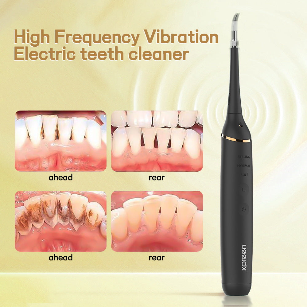 Professional Ultrasonic Teeth Cleaner - 3 Modes, IPX7 Waterproof Dental Scaler Kit with LED Light & 3 Heads(black)