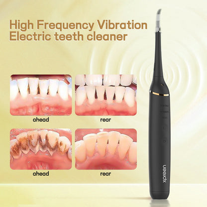 Professional Ultrasonic Teeth Cleaner - 3 Modes, IPX7 Waterproof Dental Scaler Kit with LED Light & 3 Heads(black)
